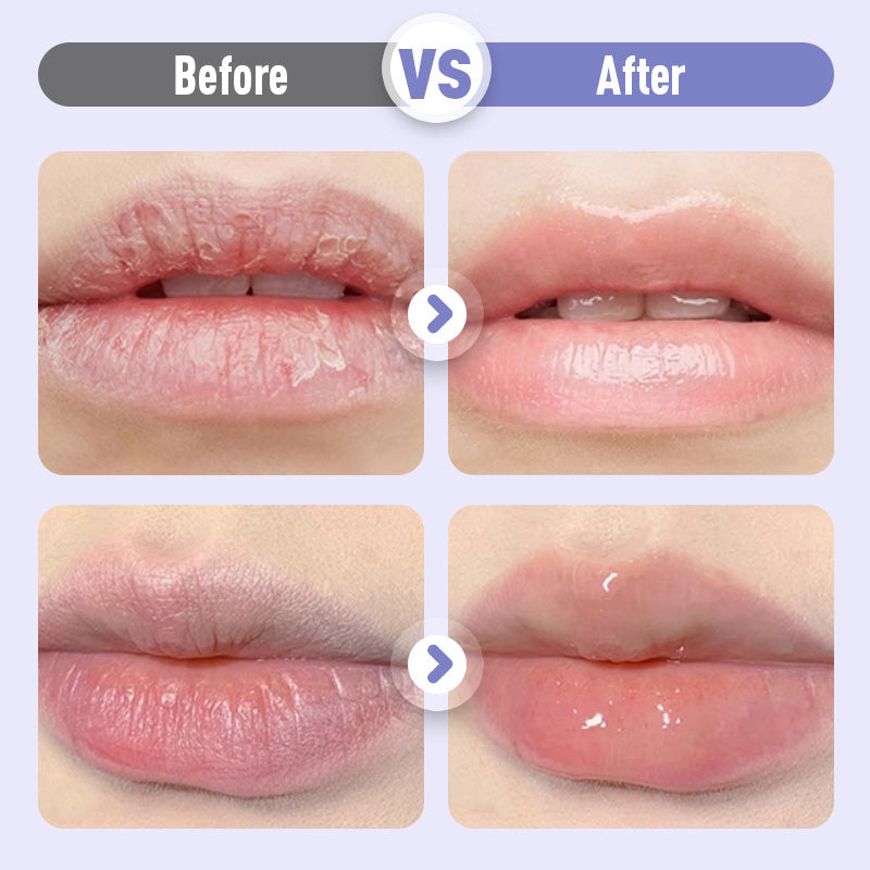 ❣️Plumping & Anti-Wrinkle Hydrating Lip Serum